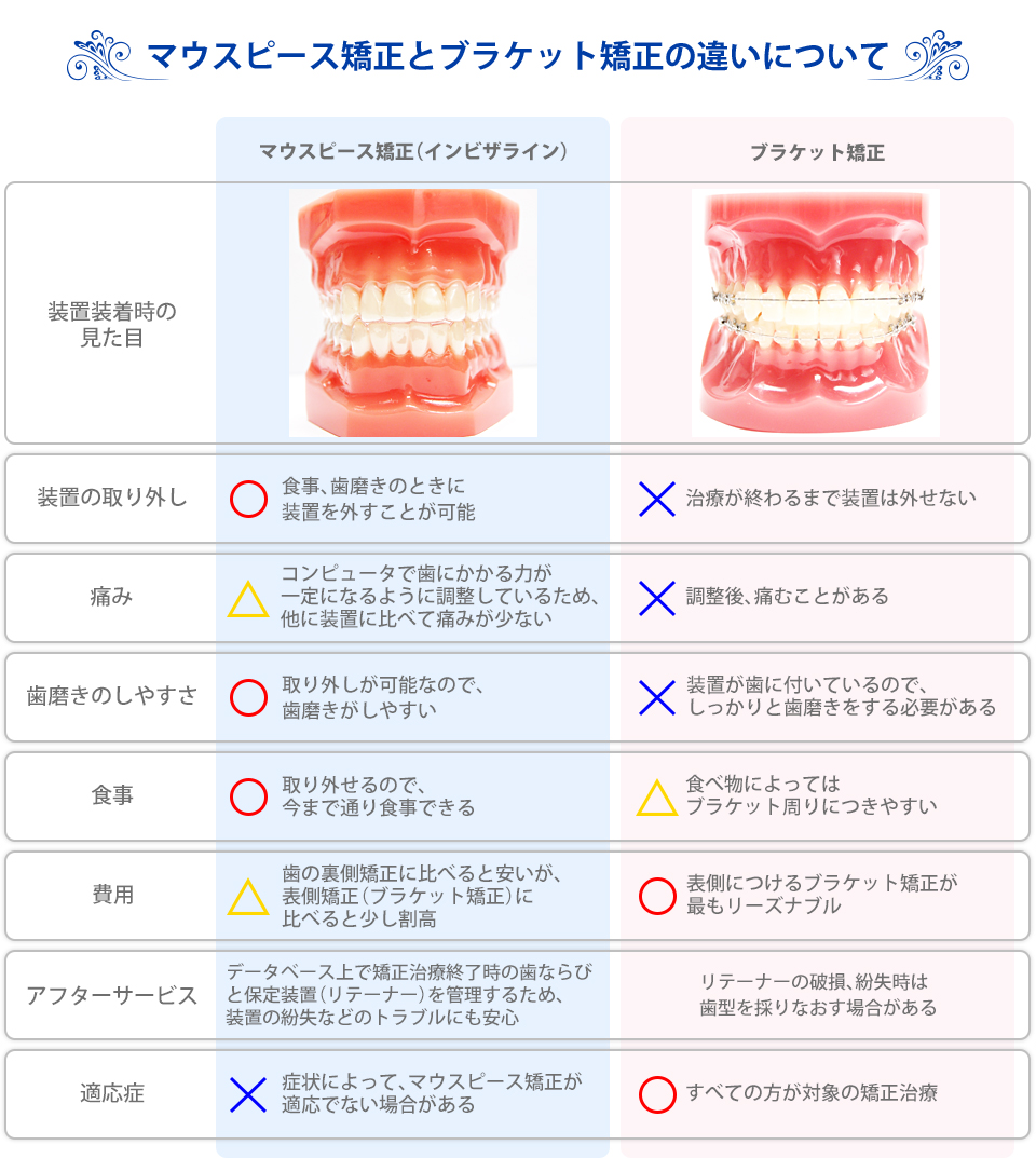 マウスピース矯正とブラケット矯正の違いについて(パソコン)